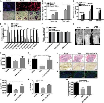 CircHmbox1 Targeting miRNA-1247-5p Is Involved in the Regulation of Bone Metabolism by TNF-α in Postmenopausal Osteoporosis